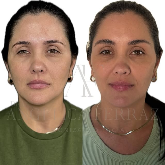 WhatsApp Image 2026-01-12 at 19.25.05